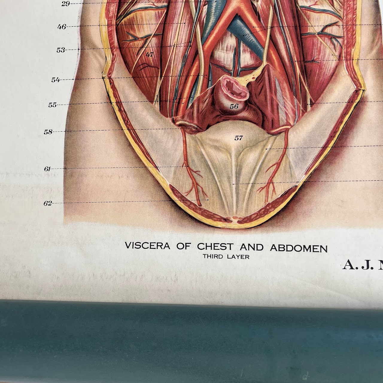 American Frohse Max Brodel Thoracic and Abdominal Viscera Anatomy Chart, 1918