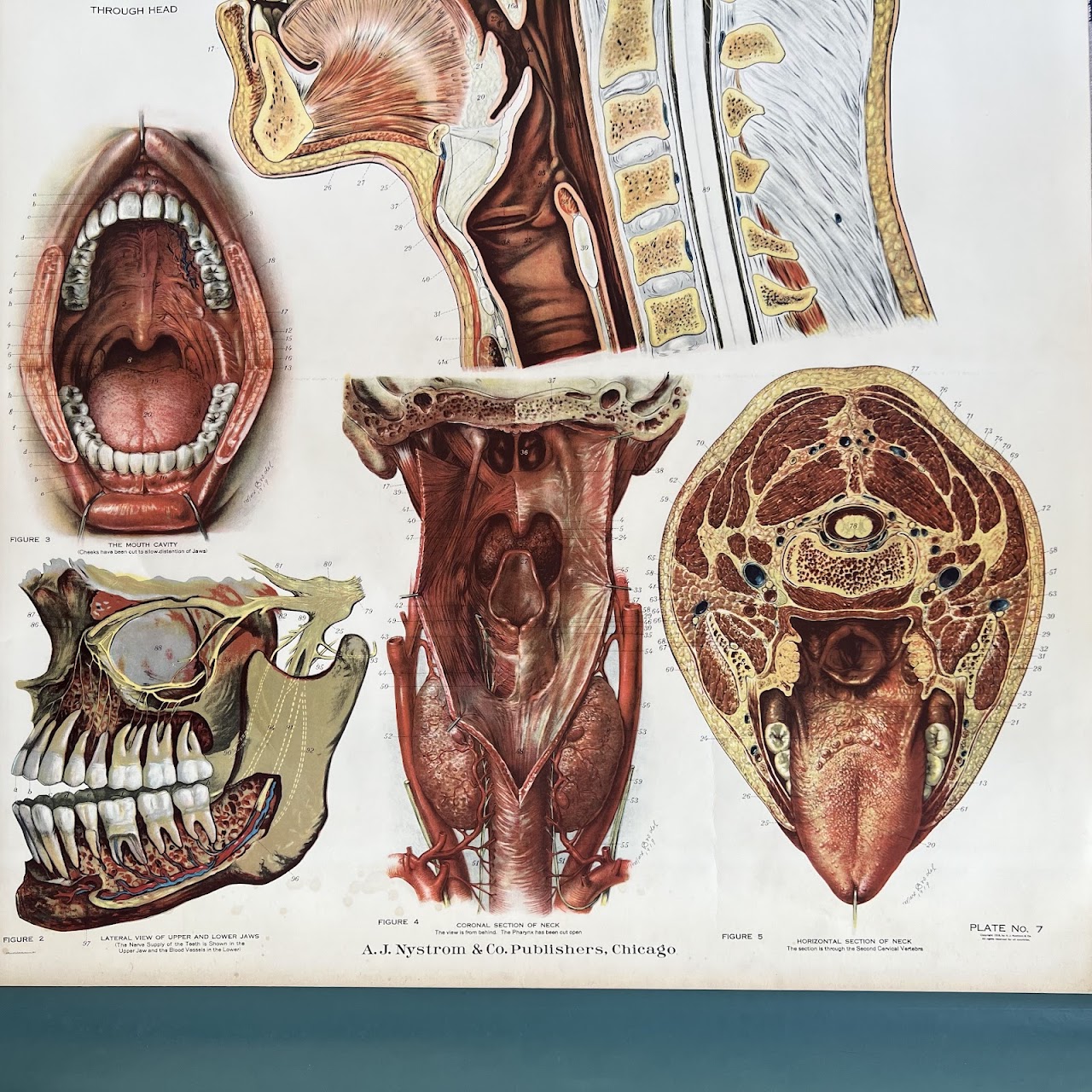 American Frohse Max Brodel Head and Neck Anatomy Chart, 1918